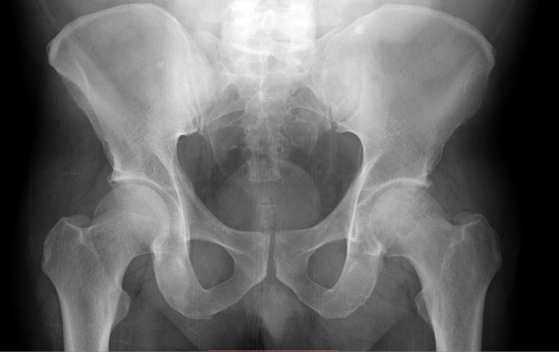 diagnosis of the hip joint