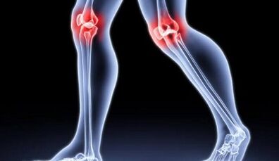 Prevention of arthritis and arthrosis