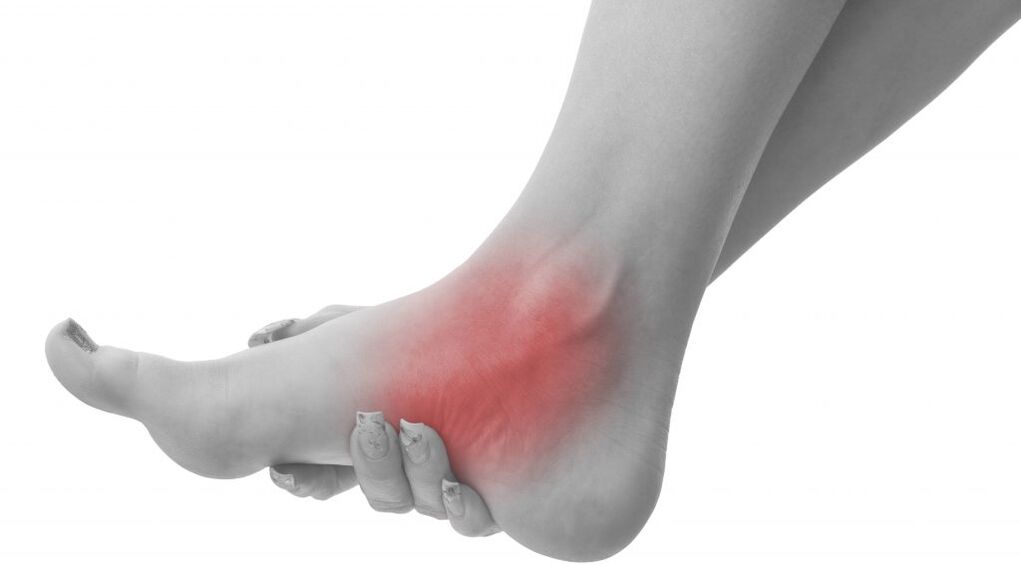 Pain in the ankle joint due to arthrosis