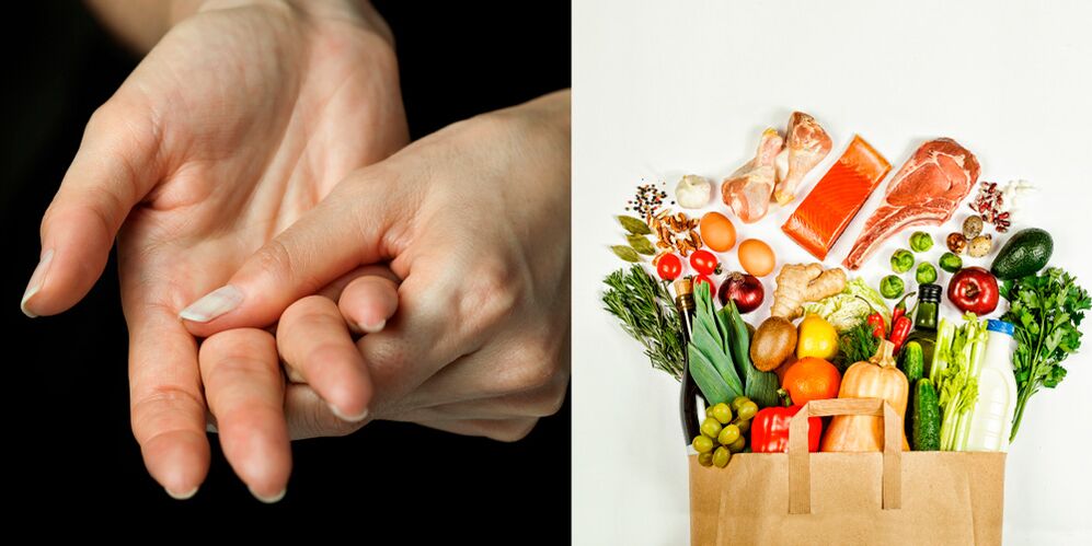 foods for the treatment of gouty arthritis of the hands